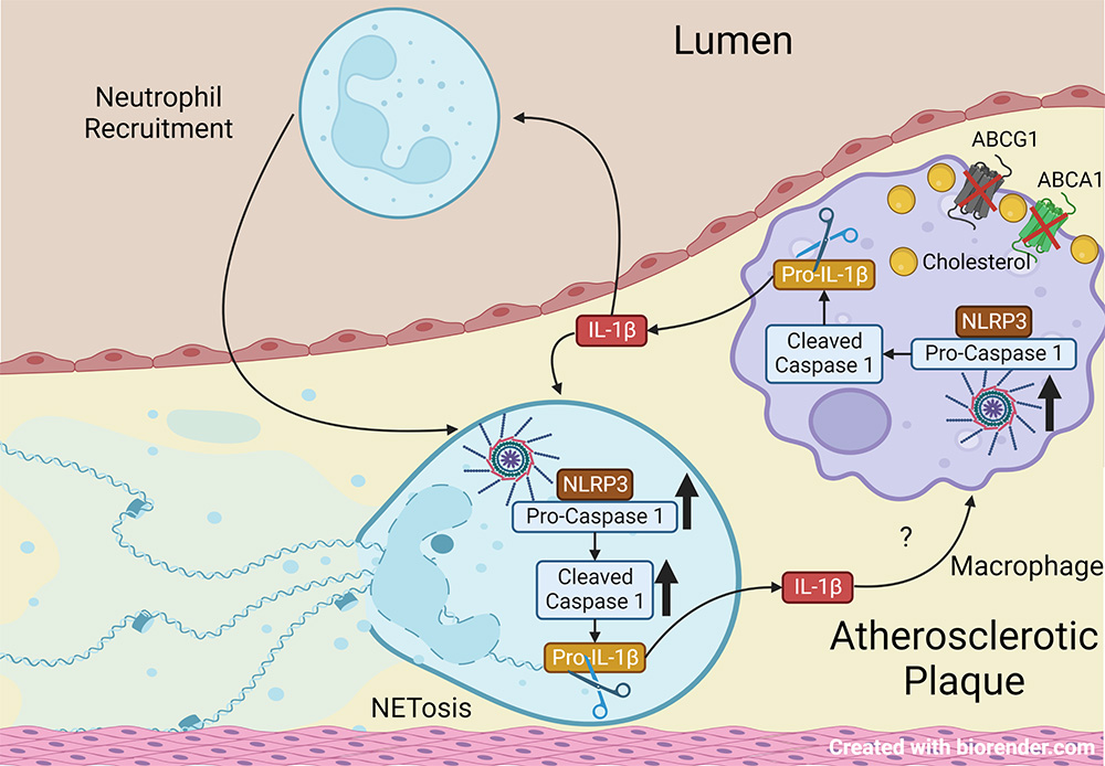 Graphical abstract with IL1B Neutrophil and Citation