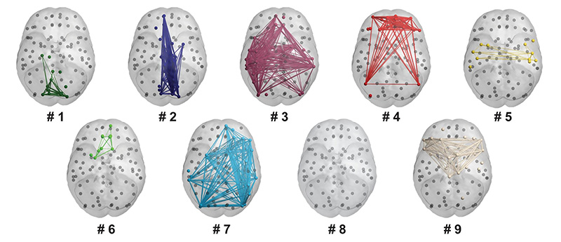 Neuroticism network